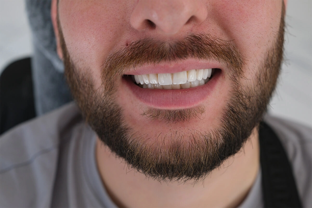 Kosmetische Zahnheilkunde