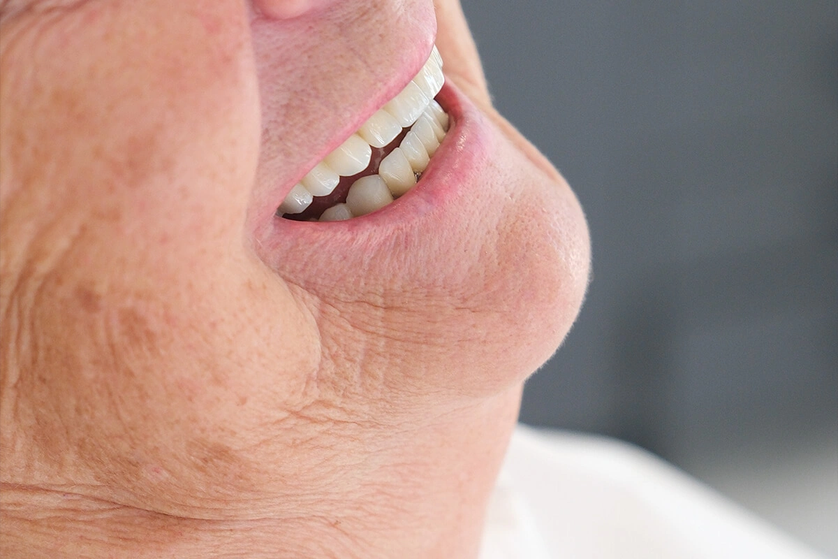 Natürliche Lächeln-Ästhetik