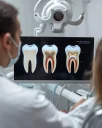 What Happens If a Decayed Tooth Is Not Treated
