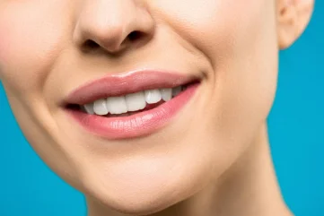 Как проводится процедура отбеливания зубов - Moon Dental Alanya Blog