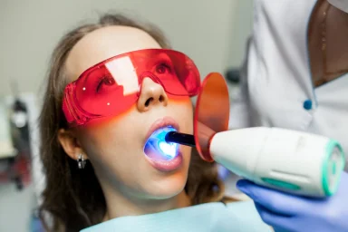 Blanchiment Dentaire Professionnel Confiez Votre Sourire à des Mains Expertes Guide de l’Esthétique Dentaire