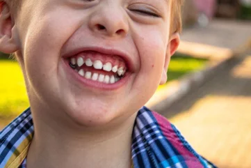 L’importance de préserver la santé dentaire des enfants - Moon Dental Alanya Blog