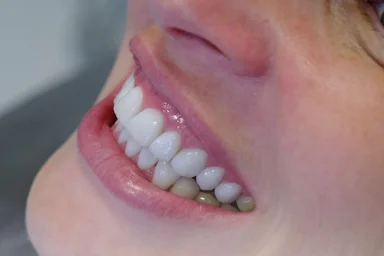  5 Vorteile einer Zahnbehandlung in Alanya in der Moon D.C. Dental Clinic