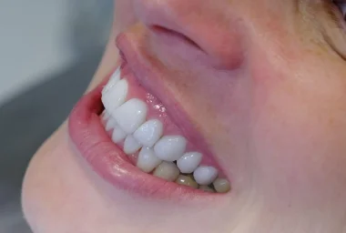 5 Преимуществ Лечения Зубов в Алании в Moon D.C. Dental Clinic