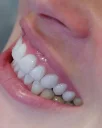 5 Advantages of Dental Treatment in Alanya at Moon D.C. Dental Clinic