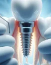 Alanya Implantatpreise 2024 | Erschwingliche und hochwertige Zahnbehandlung