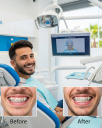 Alanya’da Hızlı Diş Teli (Fastbraces) Tedavisi: Avantajları ve Fiyatları