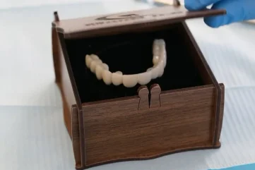 Cliniques dentaires à Alanya : Applications d’implants multiples et processus de guérison - Moon Dental Alanya Blog