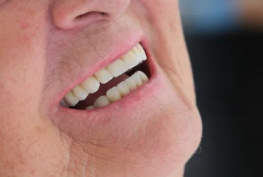 Cliniques dentaires d’Alanya : Ajustements esthétiques pour un sourire parfait