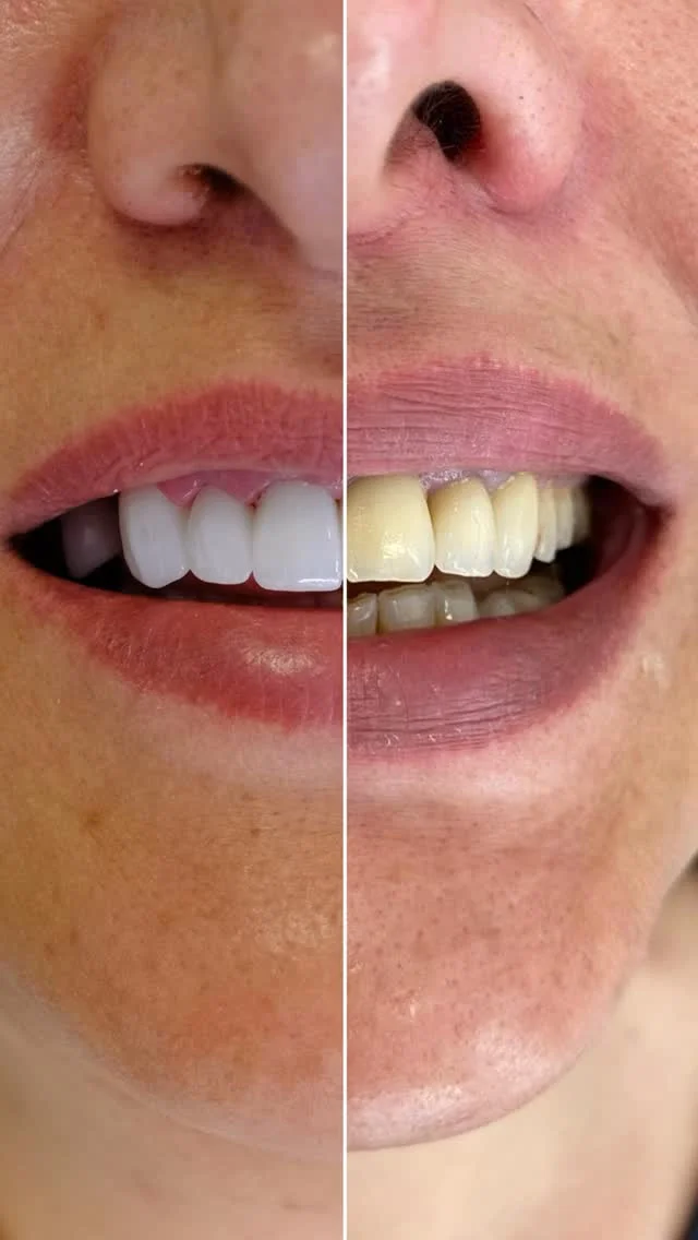 Zahnreinigung in Alanya: Die besten Kliniken und umfassender Leitfaden