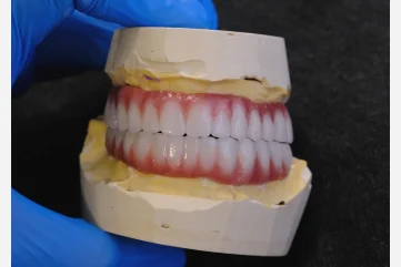 Насколько практичны зубные протезы в Аланье - Moon Dental Alanya Blog