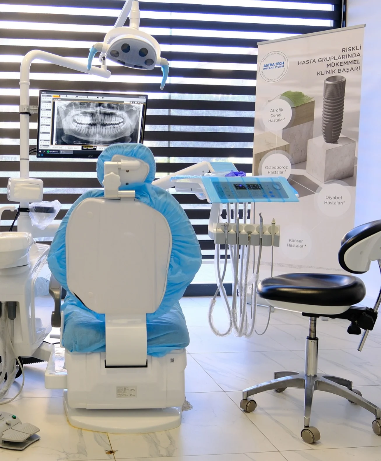 What to Do If You Have a Tooth Fracture in Alanya