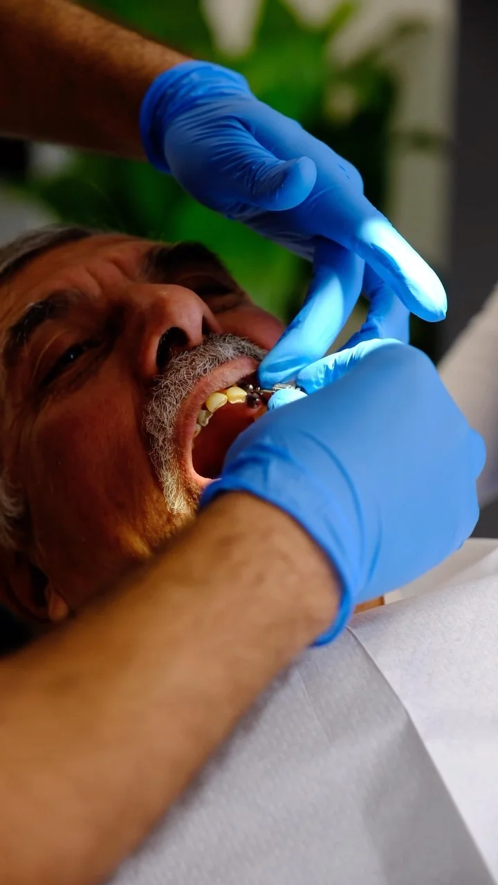 Causes and Treatment of Gum Bleeding in Alanya: Comprehensive Guide