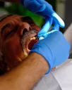 Causes and Treatment of Gum Bleeding in Alanya: Comprehensive Guide