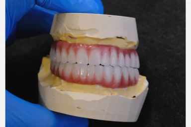  Achieving a Hollywood Smile with Full Ceramic Veneers in Alanya