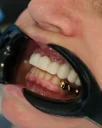 Pourquoi la santé des gencives est-elle aussi importante que votre sourire à Alanya ?